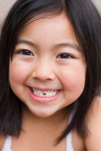 آمار بالای پوسیدگی دندان‌های دانش‌آموزان