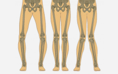 تشخیص پای پرانتزی و حرکات اصلاحی پای پرانتزی